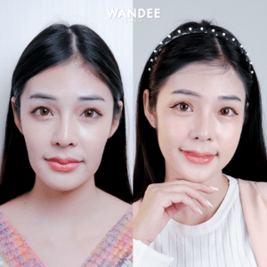 รีวิวฟิลเลอร์