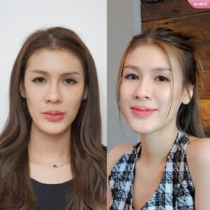 รีวิวฟิลเลอร์