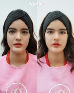 รีวิวฟิลเลอร์