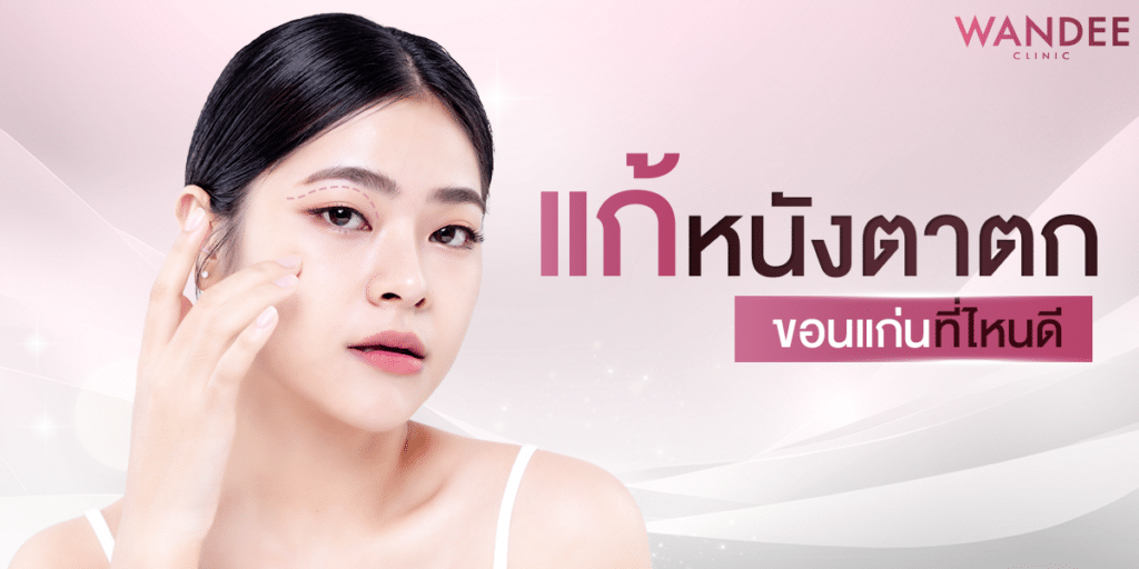 แก้หนังตาตก ขอนแก่น
