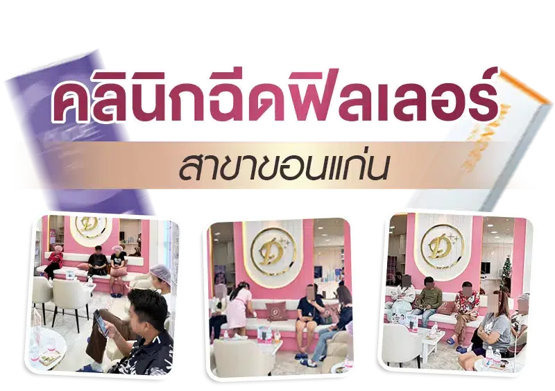 ฉีดฟิลเลอร์ Xspurt ขอนแก่น ที่ Wandee Clinic