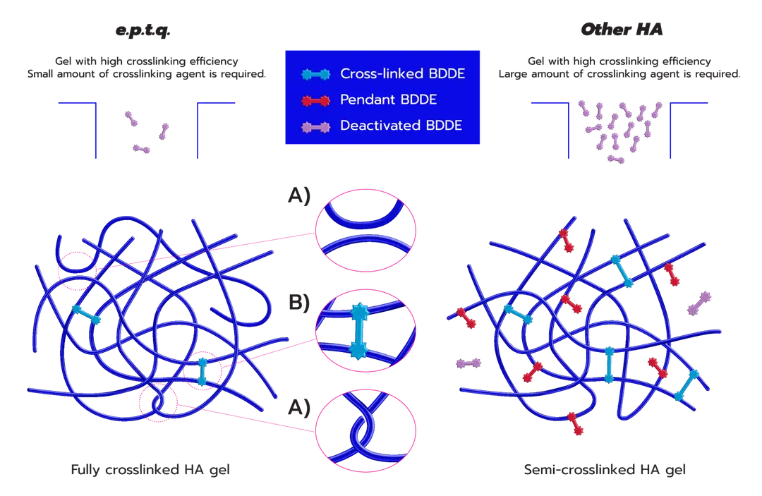 จุดเด่นของฟิลเลอร์ eptq