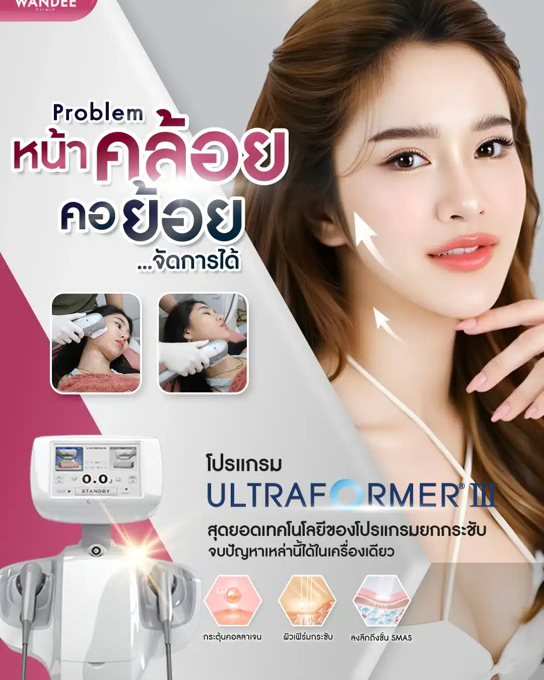 Ultraformer iii ขอนแก่น