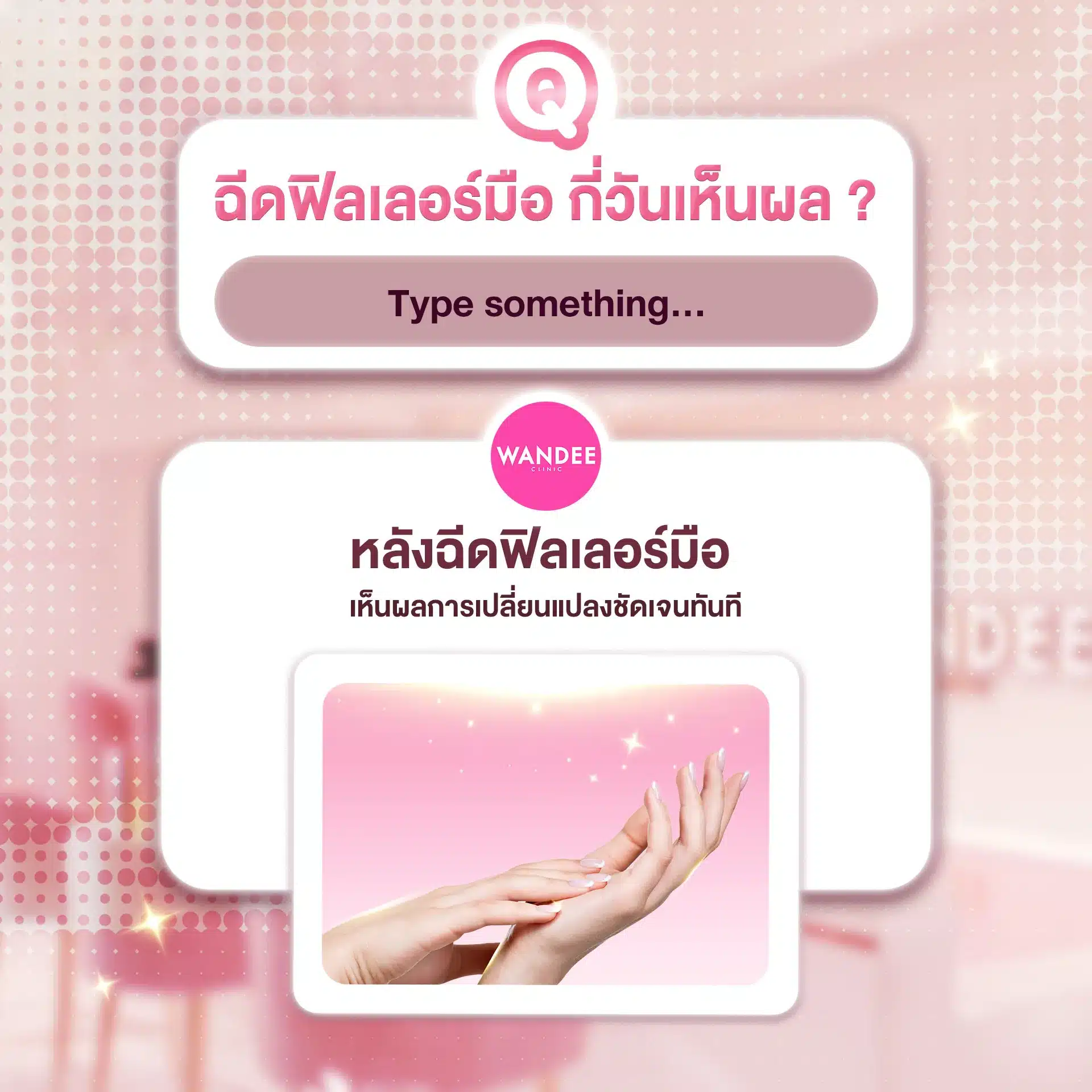 ฉีดฟิลเลอร์มือ ขอนแก่น ที่ไหนดี? ฟิลเลอร์มือ ช่วยเรื่องอะไรบ้าง ?