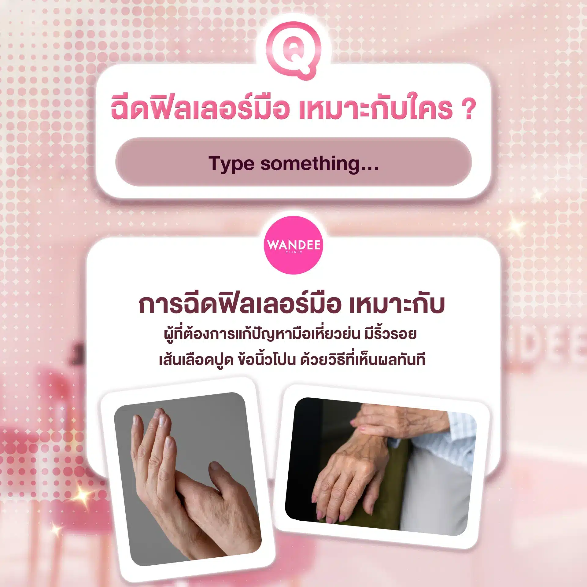 ฉีดฟิลเลอร์มือ ขอนแก่น ที่ไหนดี? ฟิลเลอร์มือ ช่วยเรื่องอะไรบ้าง ?