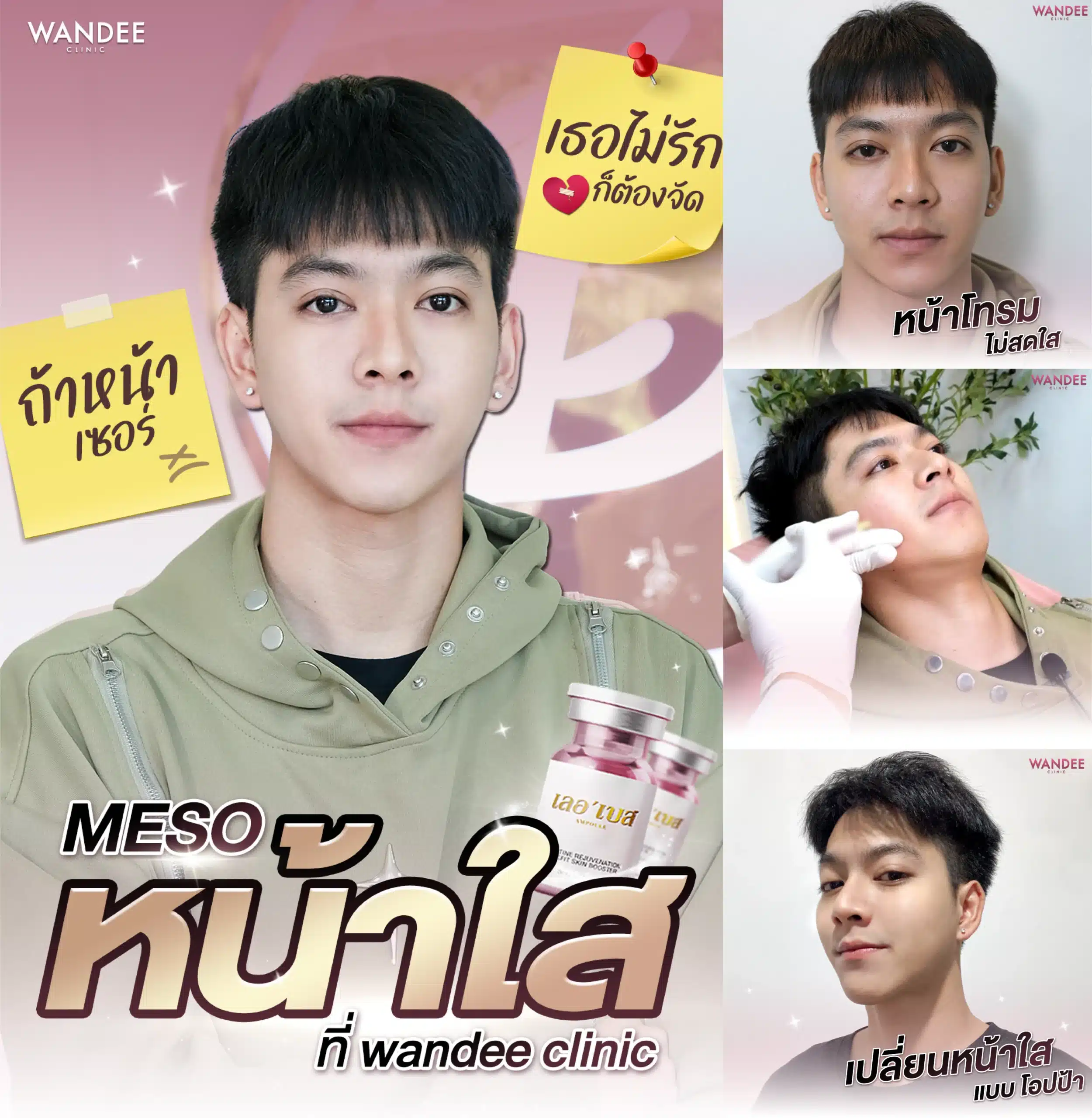 แนะนำคลินิกเติมหน้าใส L’ebss ขอนแก่น