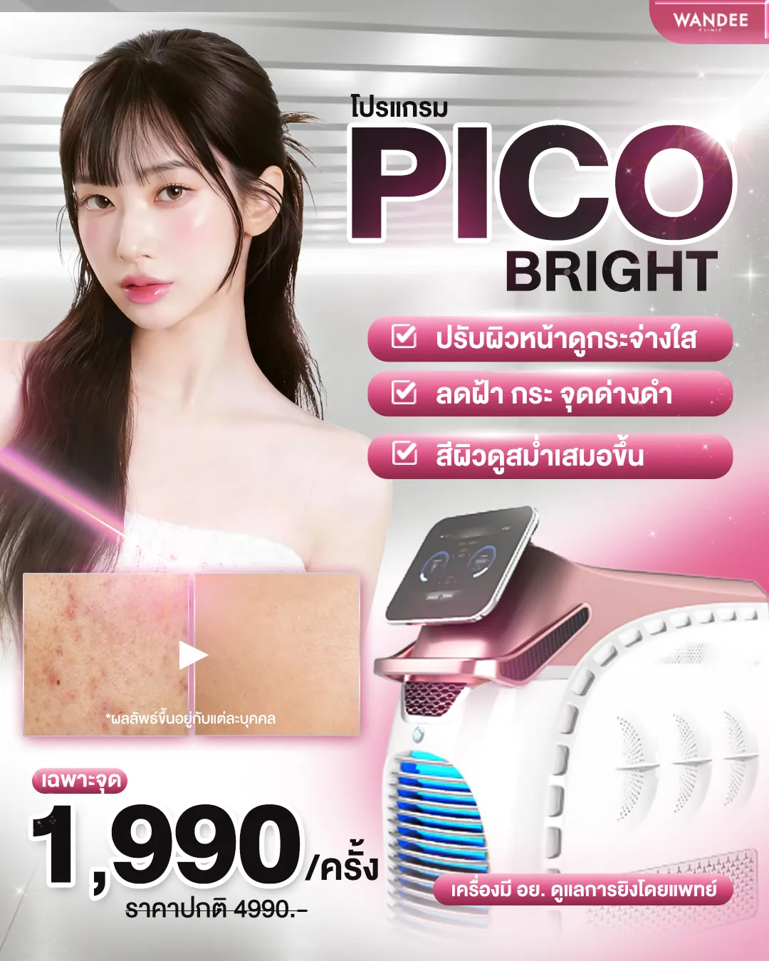 ราคาโปรแกรม pico Wandee Clinic