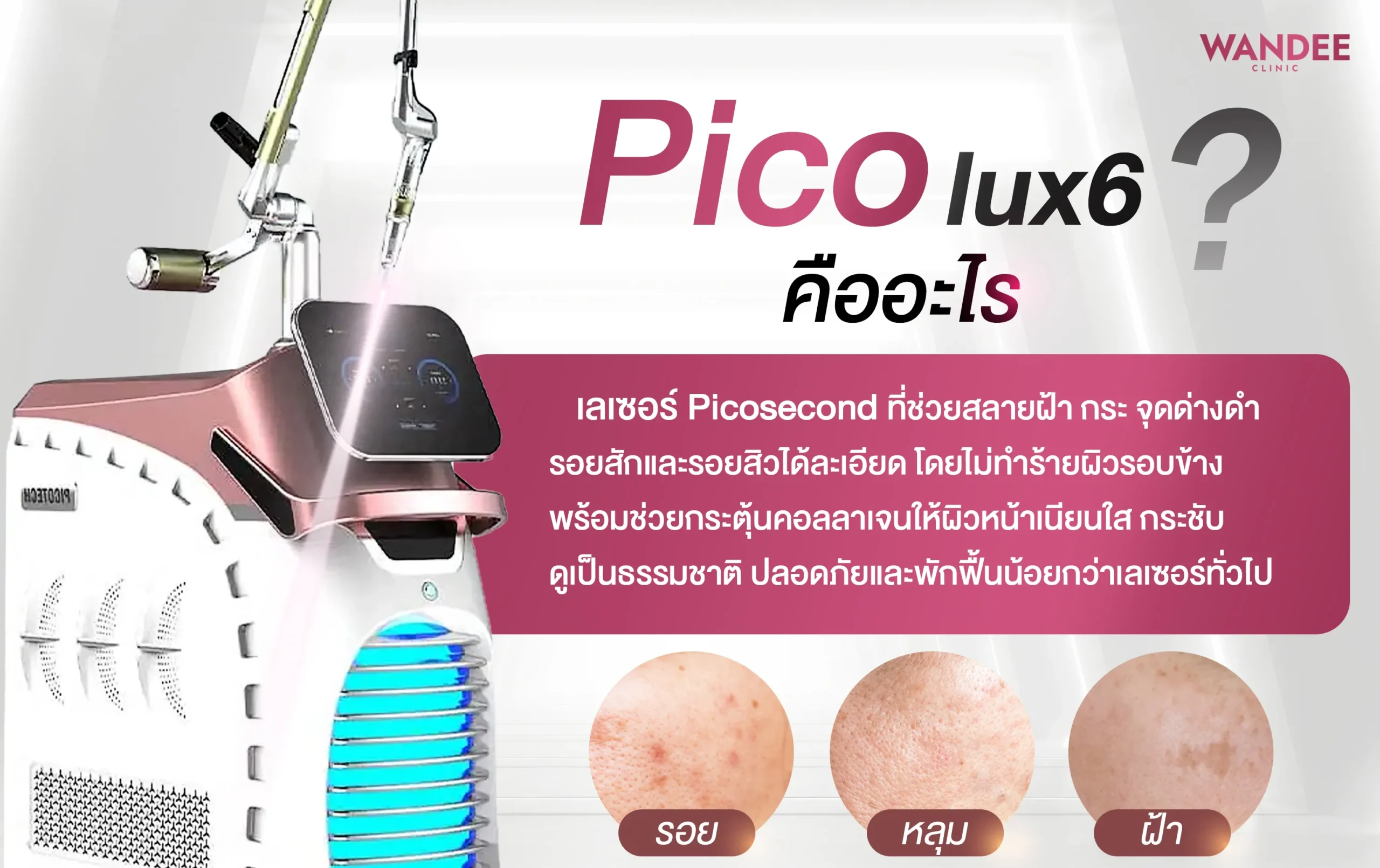 โปรแกรม pico ที่ Wandee Clinic คืออะไร