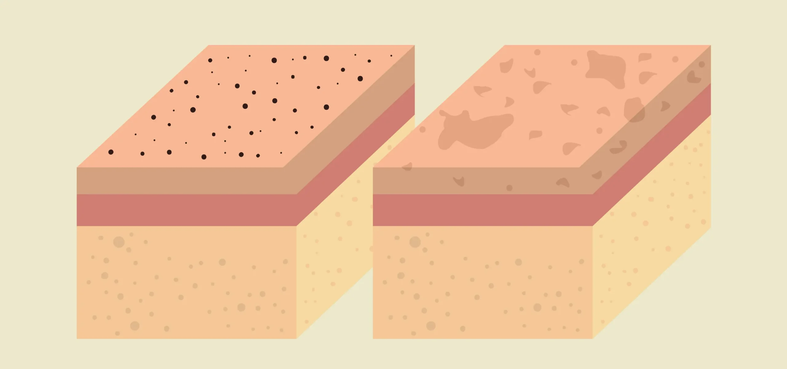 ชั้นหนังกำพร้า