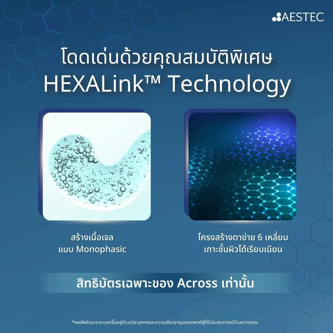 ข้อดีและข้อควรรู้ก่อนฉีด Revolax